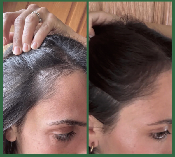 hinu - hair growth oil